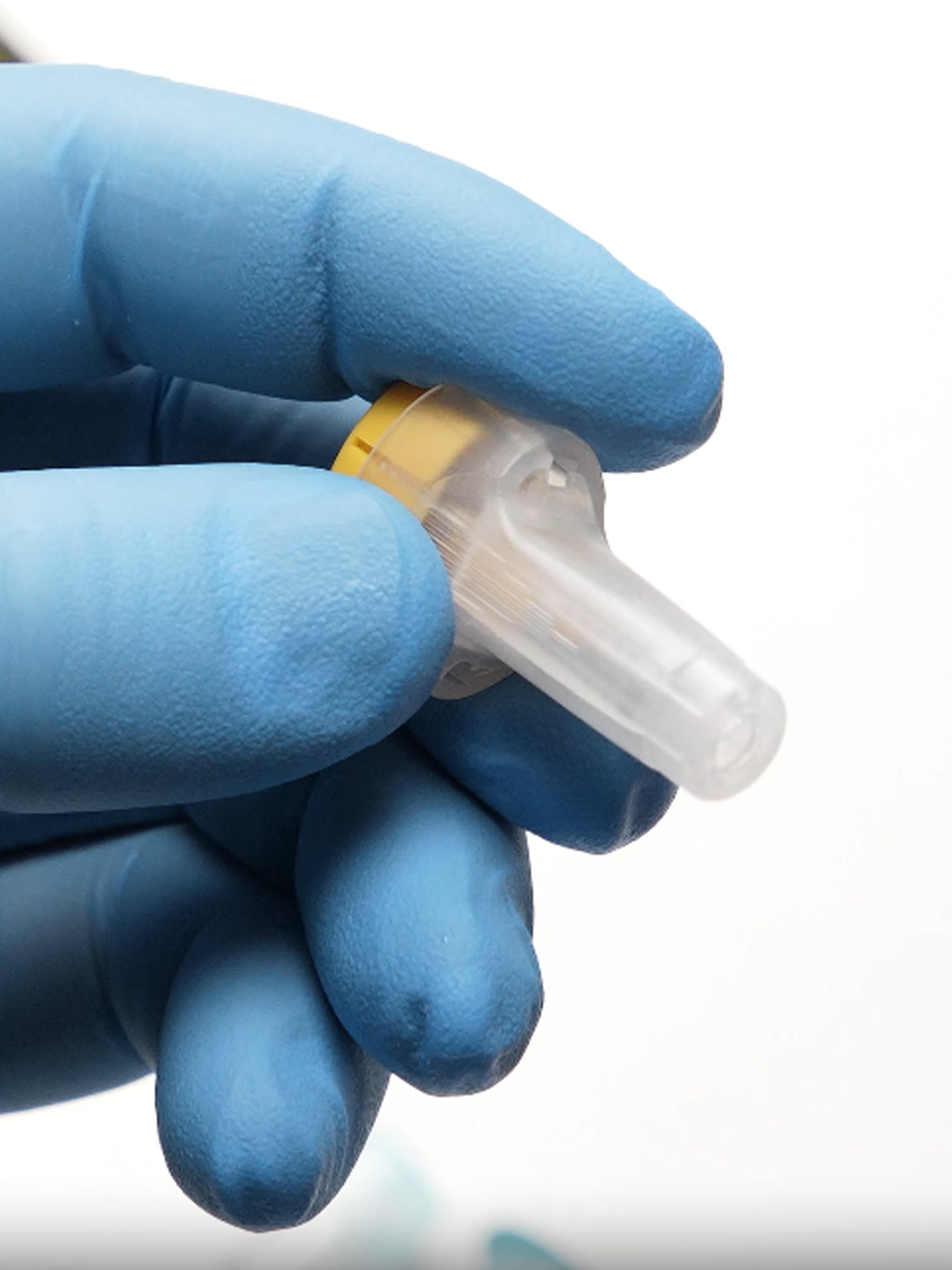 Erläuterungsvideo zur Anwendung des Vitamin D Tests.